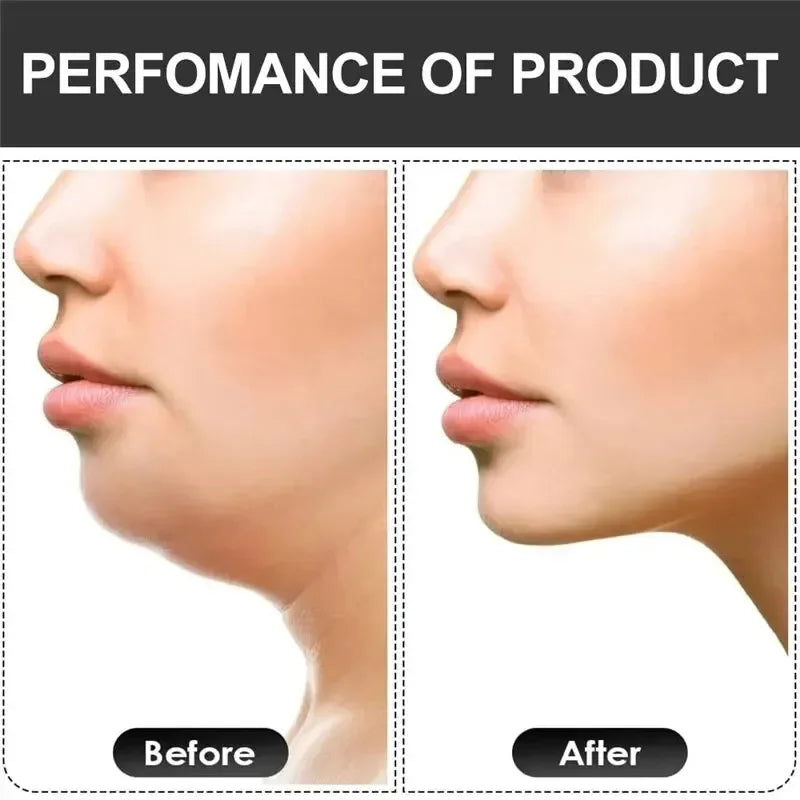 Jawzrsize, jaw exercise equipment